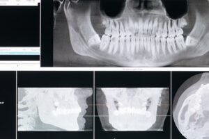 Radiologia odontológica entenda o que é e como funciona DVI Radiologia