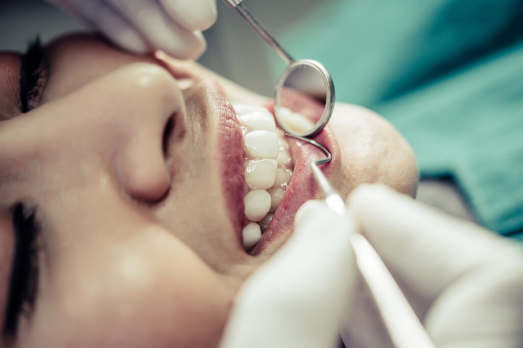 contenção periodontal